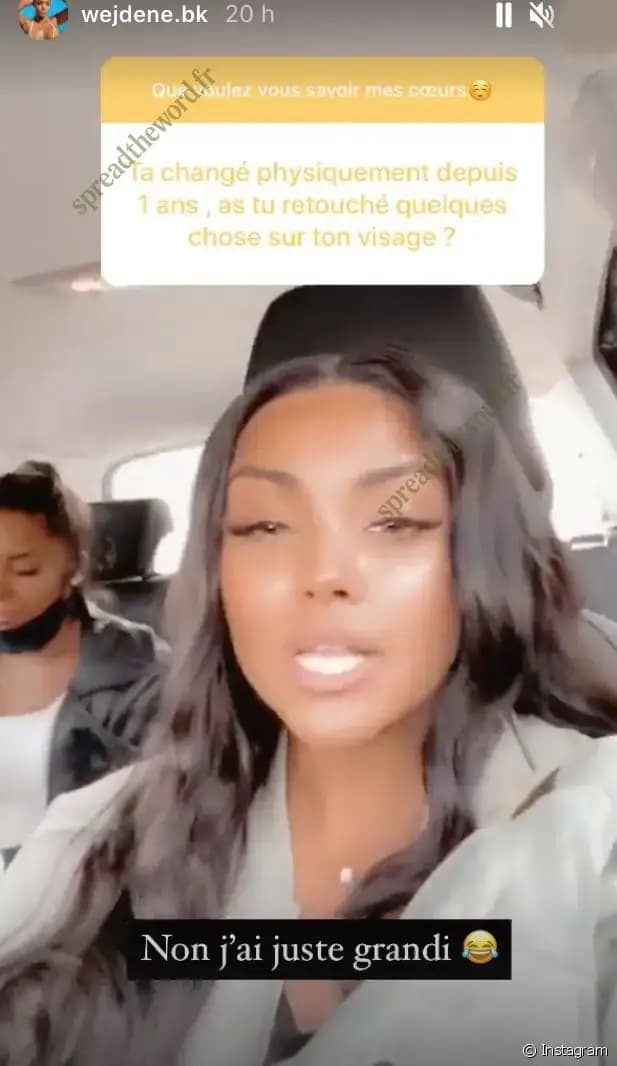 Les Détails sur la Chirurgie Esthétique de Wejdene - Ce Qu'il Faut Savoir